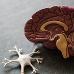 Neurologie und Schlaganfall nach Behandlungsfehlern: Ursachen, Folgen und Schadensersatzansprüche