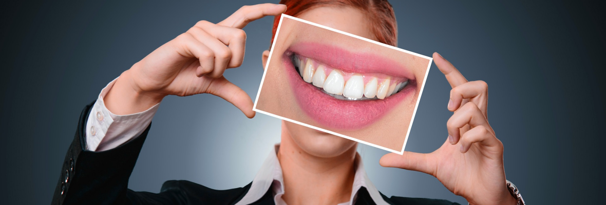 Widerrufsrecht bei Online-Kauf von Zahnschienen?